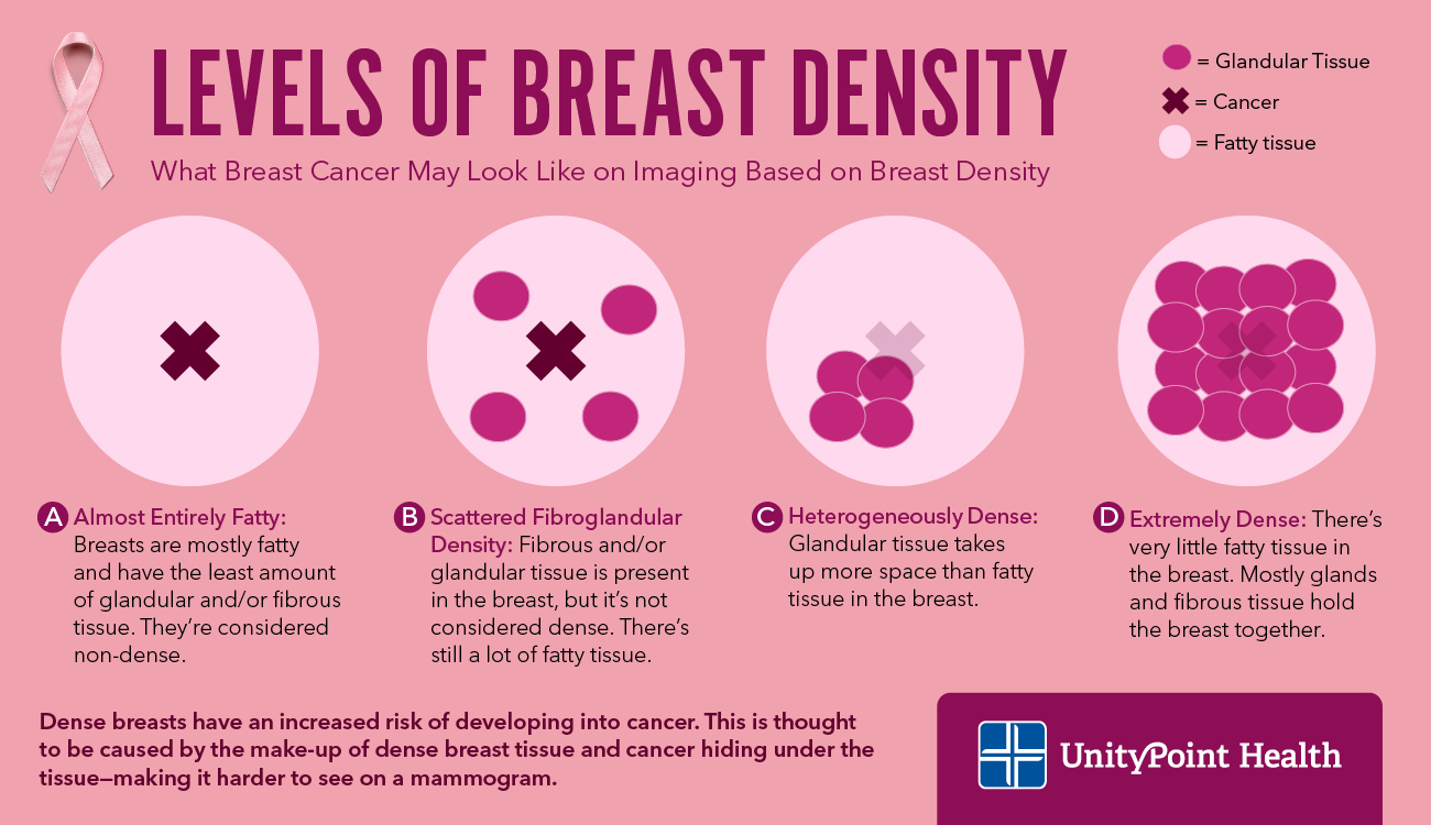 How Dense Breast Tissue Can Increase Your Breast Cancer Risk