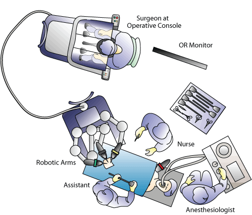 Robot-in-OR-Diagram.gif